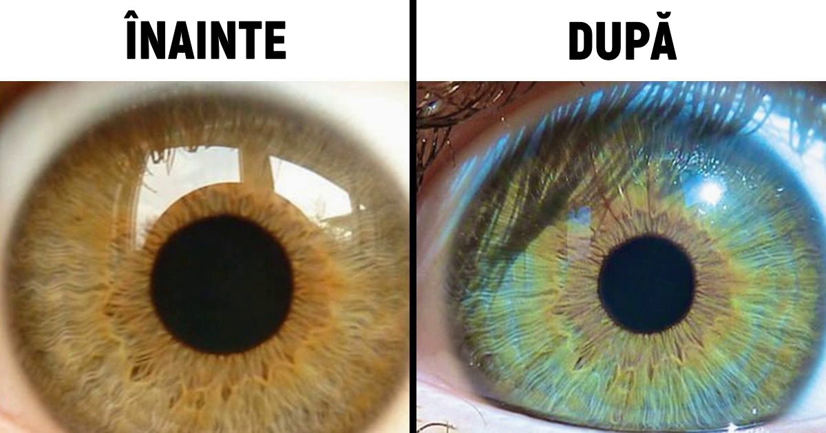 Cum se schimbă culoarea ochilor - Lentile